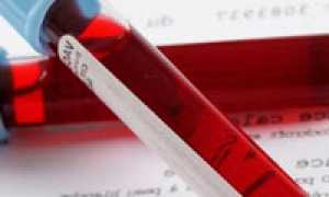 Дегидроэпиандростерон: что за гормон, каковы его функции? Анализ на ДГЭА и его трактовка