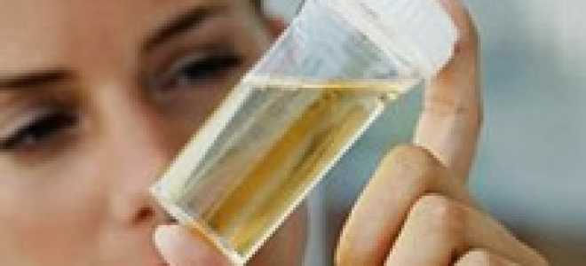 Причины резкого, неприятного запаха мочи у женщины