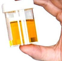 При проведении анализа мочи обязательно изучается такой показатель, как удельный вес (или плотность мочи)