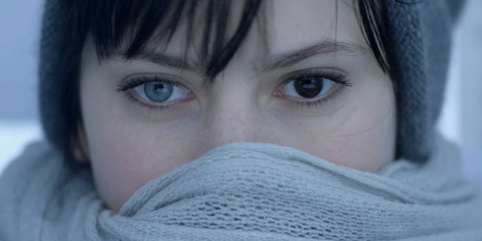 гетерохромия Фукса