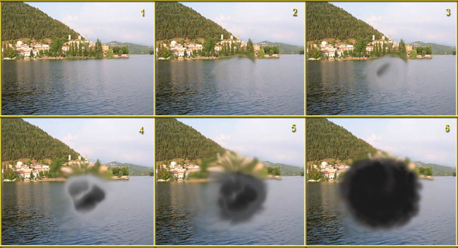 Степени центральной дистрофии глаза