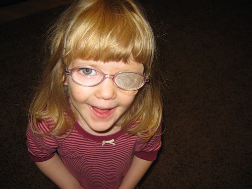 косоглазие 5