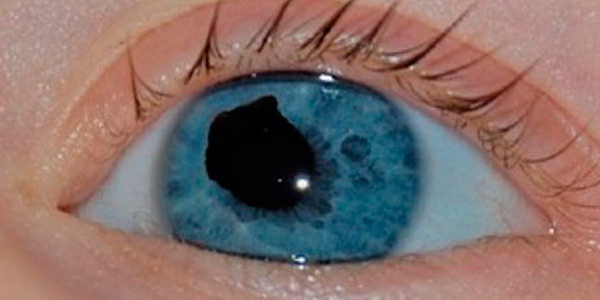зрачок 3
